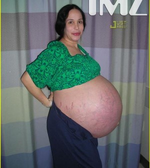 maior gravidez (Custom)